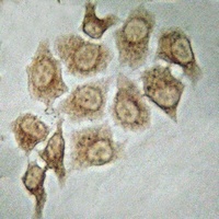 PAK4/5 Rabbit Polyclonal Antibody