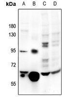 Catalase Rabbit Polyclonal Antibody