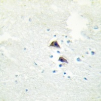 Catalase Rabbit Polyclonal Antibody
