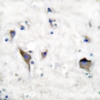 PYK2 Rabbit Polyclonal Antibody