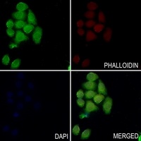 PYK2 Rabbit Polyclonal Antibody