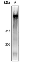 AHNAK Rabbit Polyclonal Antibody