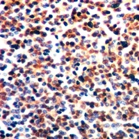 AHNAK Rabbit Polyclonal Antibody