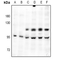 c-FER Rabbit Polyclonal Antibody