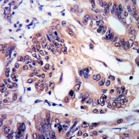 c-FER Rabbit Polyclonal Antibody