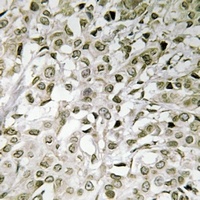 TAF1 Rabbit Polyclonal Antibody