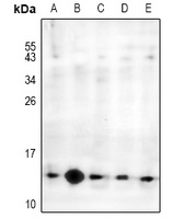 MED21 Rabbit Polyclonal Antibody