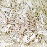 MED21 Rabbit Polyclonal Antibody