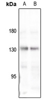 Collagen 4 alpha 3 Rabbit Polyclonal Antibody