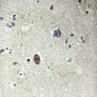 Collagen 4 alpha 3 Rabbit Polyclonal Antibody