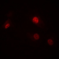 RAD23A Rabbit Polyclonal Antibody