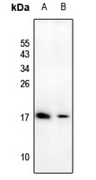 ATP5D Rabbit Polyclonal Antibody