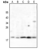 RCL Rabbit Polyclonal Antibody
