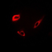 INSL4 Rabbit Polyclonal Antibody