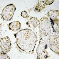 APOBEC3D Rabbit Polyclonal Antibody