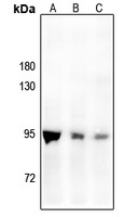 PMS2 Rabbit Polyclonal Antibody