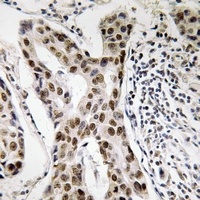 PMS2 Rabbit Polyclonal Antibody