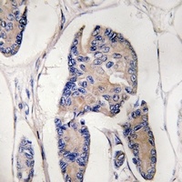 ULK1 Rabbit Polyclonal Antibody