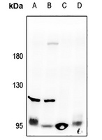 Collagen 2 alpha 1 Antibody