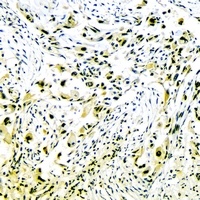 Collagen 2 alpha 1 Antibody