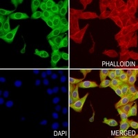 Collagen 2 alpha 1 Antibody