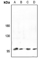 Collagen 2 alpha 1 Antibody