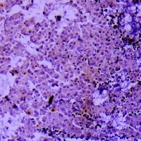 Collagen 2 alpha 1 Rabbit Polyclonal Antibody