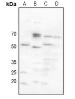 CHRM2 Rabbit Polyclonal Antibody