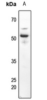 CD63 Rabbit Polyclonal Antibody