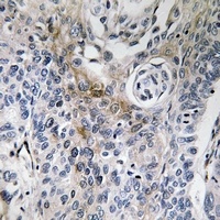 CD63 Rabbit Polyclonal Antibody