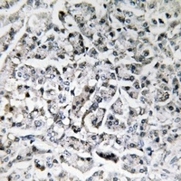 IL-11 Antibody
