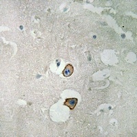 NMDAR2D Rabbit Polyclonal Antibody