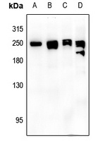 NEFH Rabbit Polyclonal Antibody