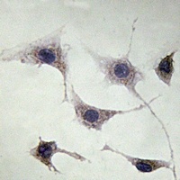 NEFH Rabbit Polyclonal Antibody