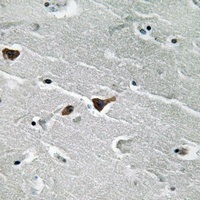 PAI1 Rabbit Polyclonal Antibody