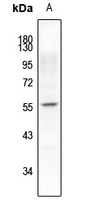 Synaptotagmin (Phospho-S309/306) Rabbit Polyclonal Antibody