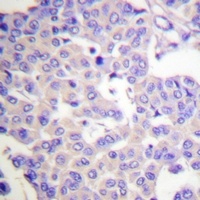 Synaptotagmin (Phospho-S309/306) Rabbit Polyclonal Antibody