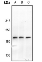 ABL1/2 (Phospho-Y393/439) Rabbit Polyclonal Antibody