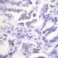 ABL1/2 (Phospho-Y393/439) Rabbit Polyclonal Antibody