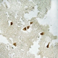 GRLF1 (Phospho-Y1105) Rabbit Polyclonal Antibody