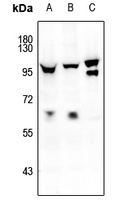 FOXO1/3/4 (Phospho-T24/32) Rabbit Polyclonal Antibody