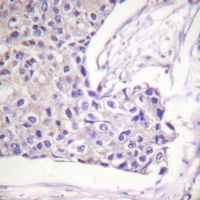 FOXO1/3/4 (Phospho-T24/32) Rabbit Polyclonal Antibody