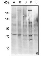 c-RAF (Phospho-Y341) Rabbit Polyclonal Antibody