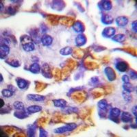 c-RAF (Phospho-Y341) Rabbit Polyclonal Antibody