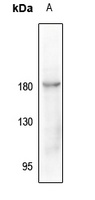 CD115 (Phospho-Y723) Rabbit Polyclonal Antibody