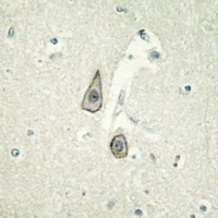 CD115 (Phospho-Y723) Rabbit Polyclonal Antibody