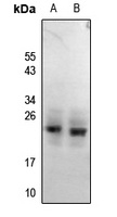 RGS1/8/16 (Phospho-Y187/159/168) Rabbit Polyclonal Antibody