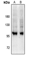 GEF H1 (Phospho-S885) Rabbit Polyclonal Antibody