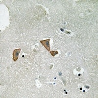 GEF H1 (Phospho-S885) Rabbit Polyclonal Antibody