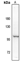 NF-kappaB p100 (Phospho-S869) Rabbit Polyclonal Antibody